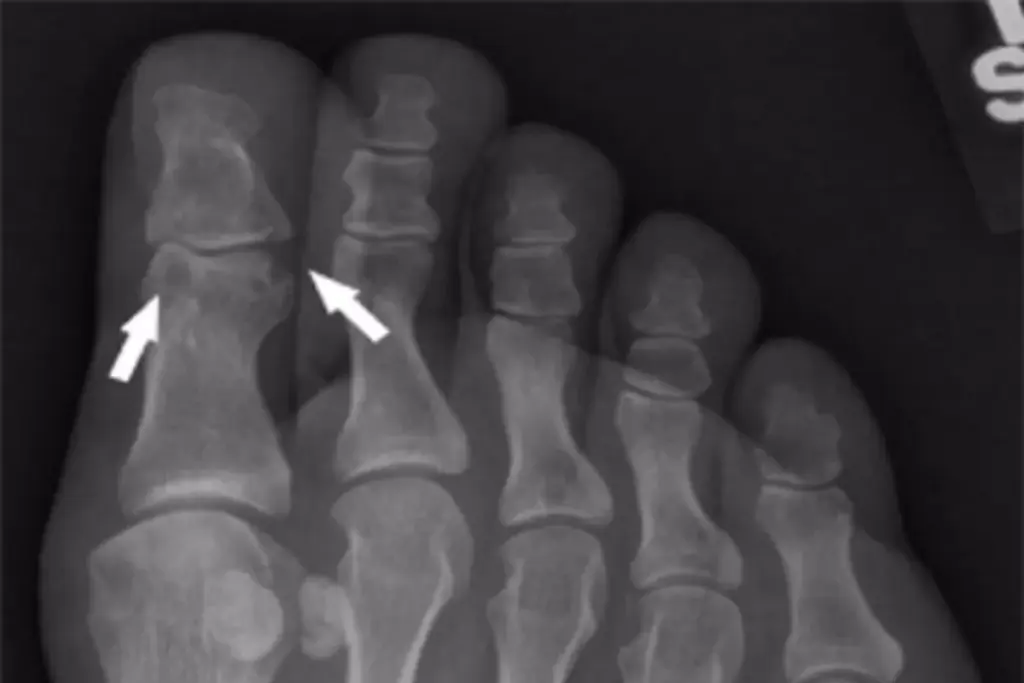 image 13 4 LIV Hospital