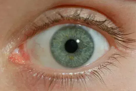 The Middle Layer of the Eyeball: Structure and Components