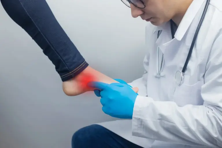 How to Treat Ankle Medial Ligament Injury