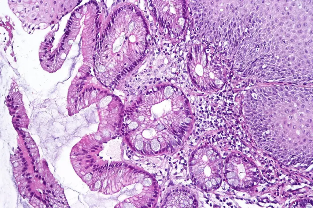 image 10 16 LIV Hospital