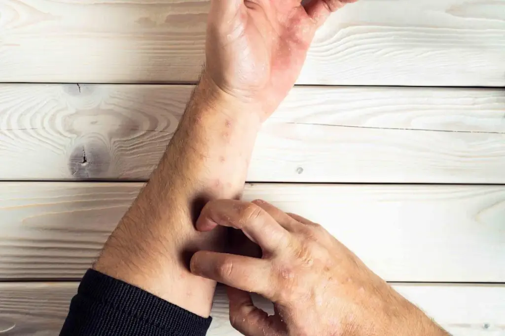 image 11 23 LIV Hospital