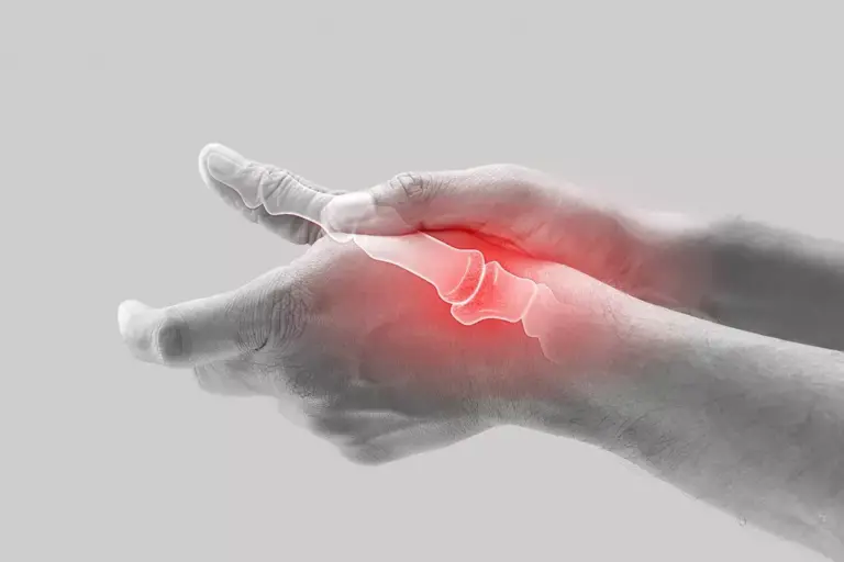 How to Relieve Sore Wrist and Thumb Pain