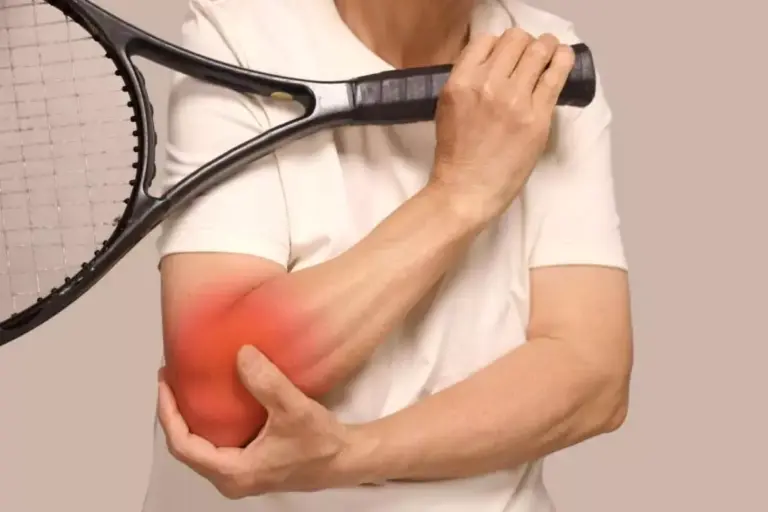 How to Prevent Tennis Elbow: 5 Ways to Stop Elbow Pain When Lifting and Gripping