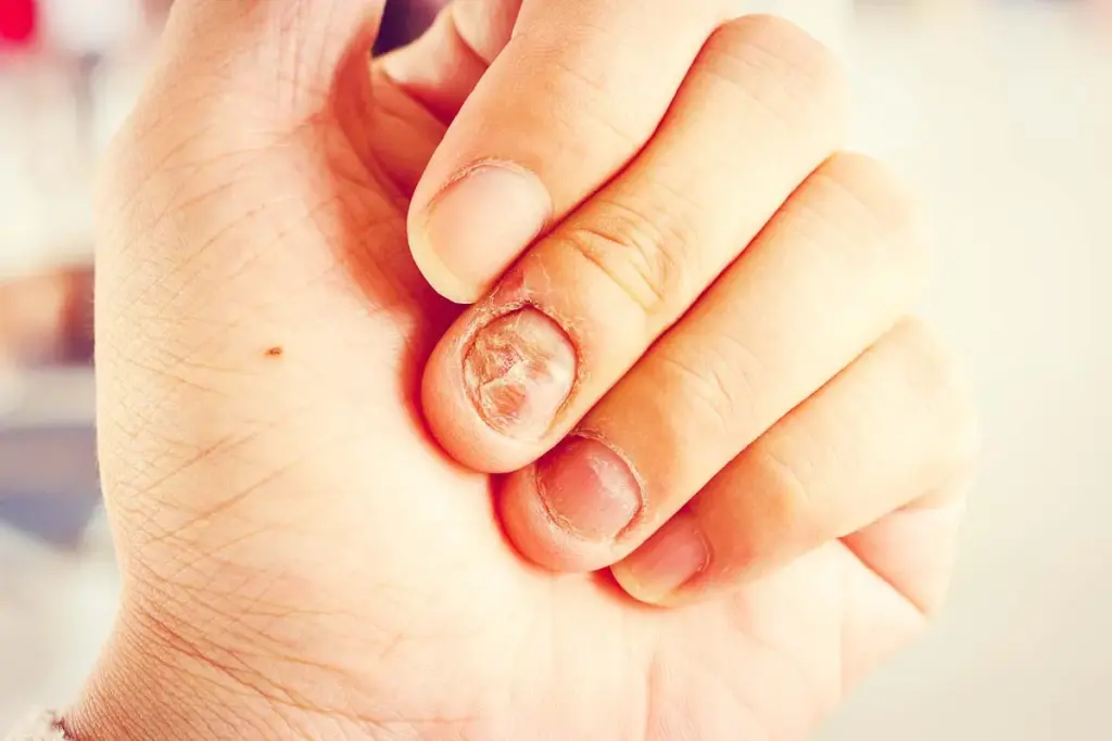 image 10 29 LIV Hospital