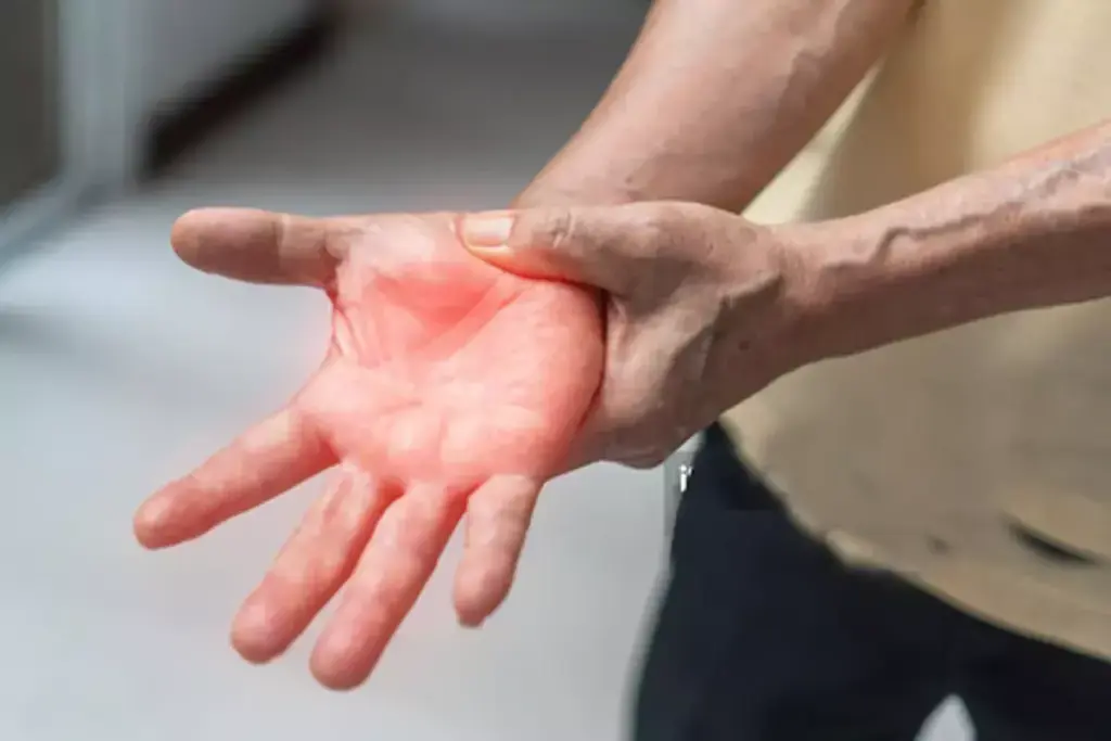 How to Treat Ulnar Nerve Injury: A Step-by-Step Guide 1 image 5610 LIV Hospital