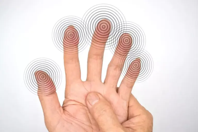 Ulnar Nerve Dermatome: 5 Key Distribution Areas