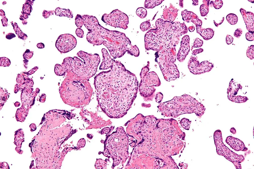 image 3 27 LIV Hospital