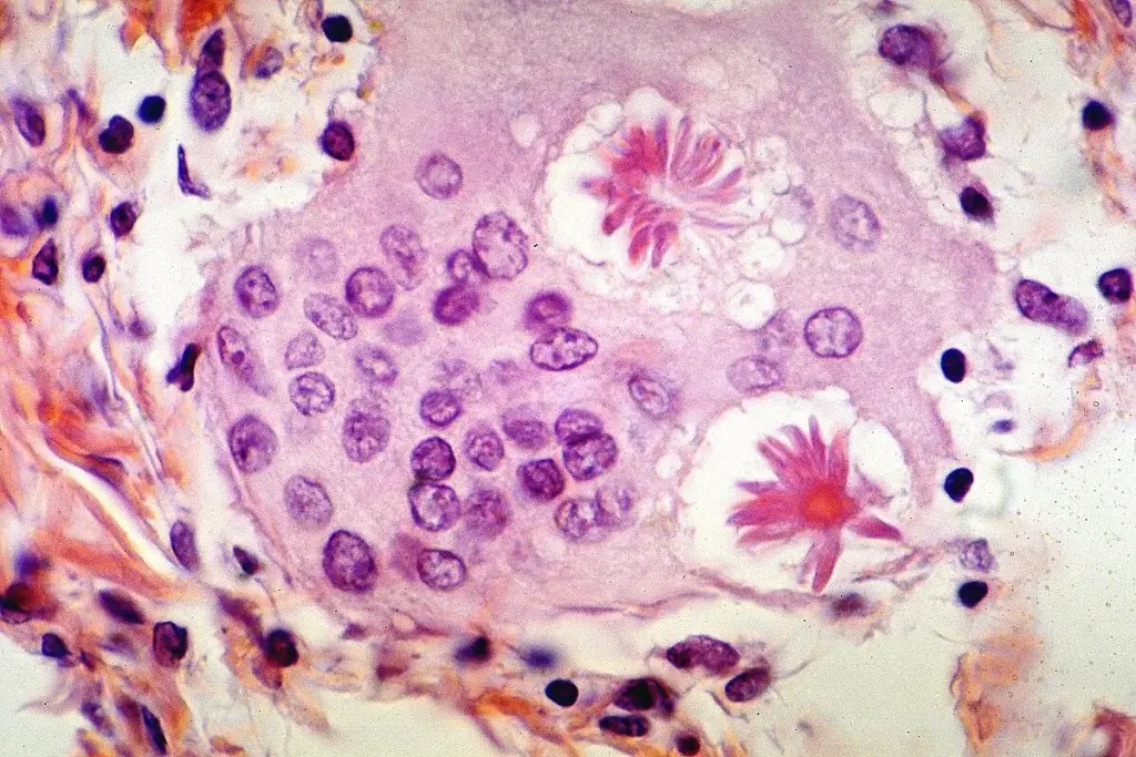 image 9 27 LIV Hospital