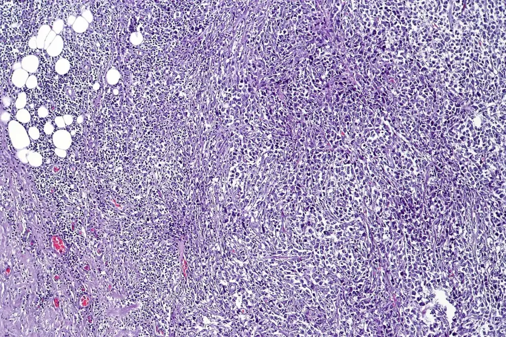 image 2 29 LIV Hospital