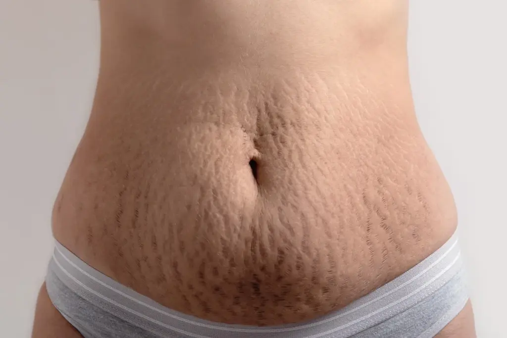 image 6 39 LIV Hospital