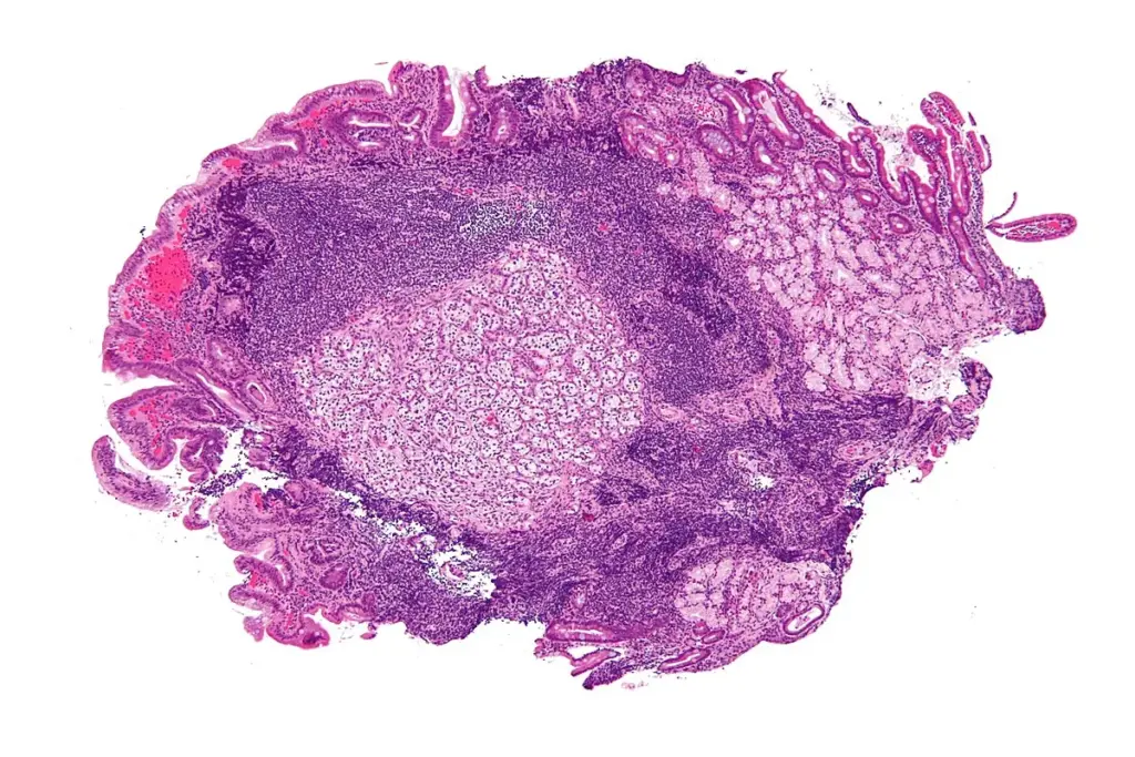 image 3 47 LIV Hospital