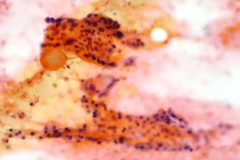 image 14 43 LIV Hospital