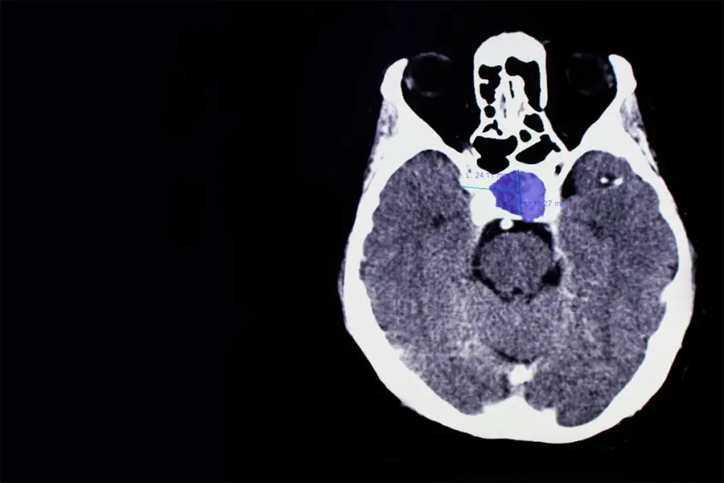 image 5 47 LIV Hospital