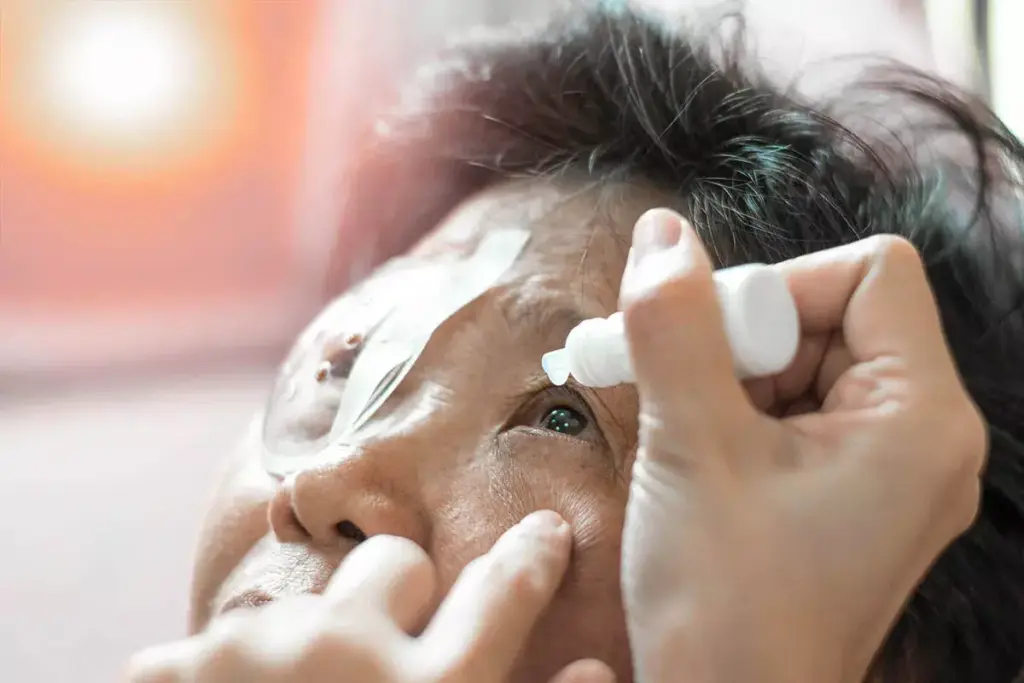 Understanding Post-Cataract Surgery Recovery