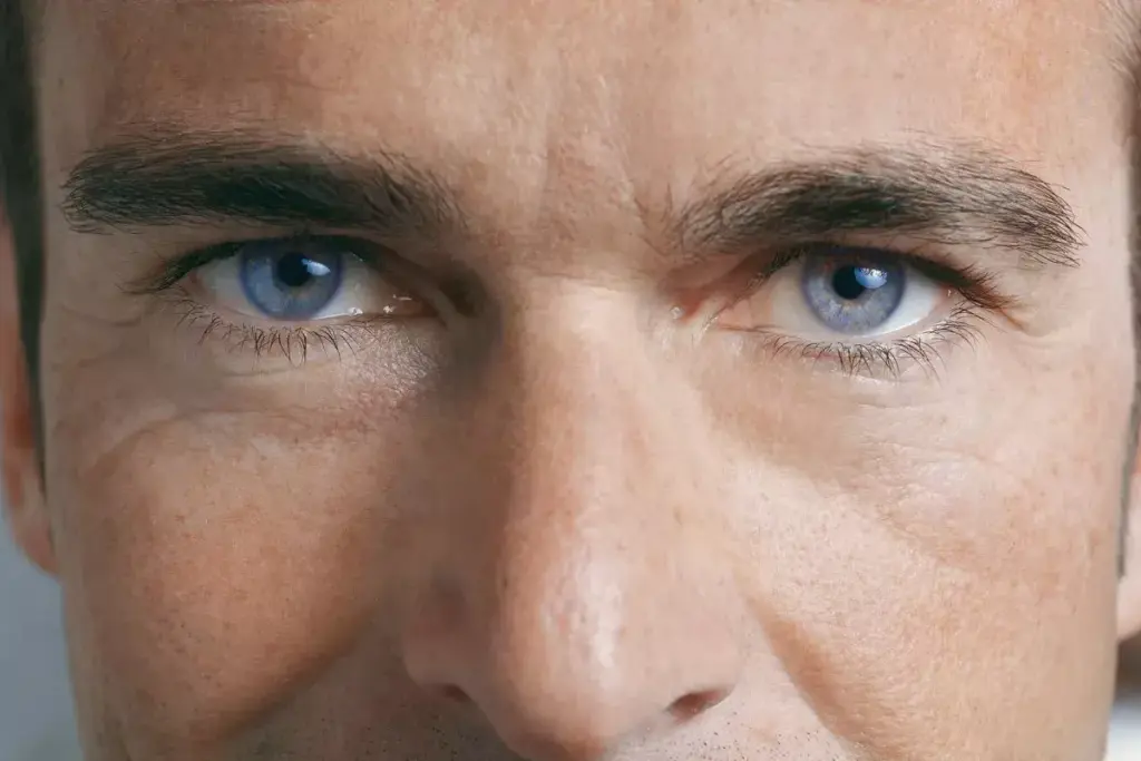 Why Is One Eye Lower Than the Other? 2 Understanding Eye Asymmetry