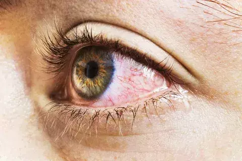 image 6541 LIV Hospital