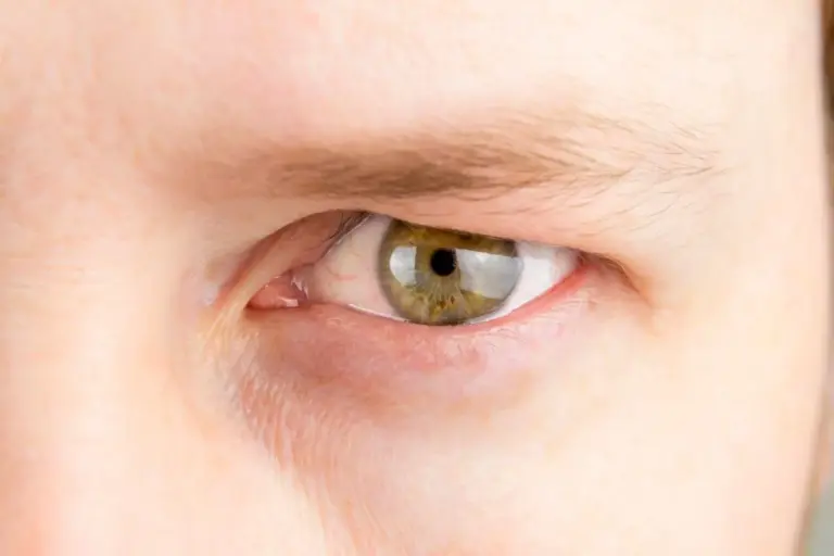 Why Do I Have Uneven Eyes? Common Causes Explained