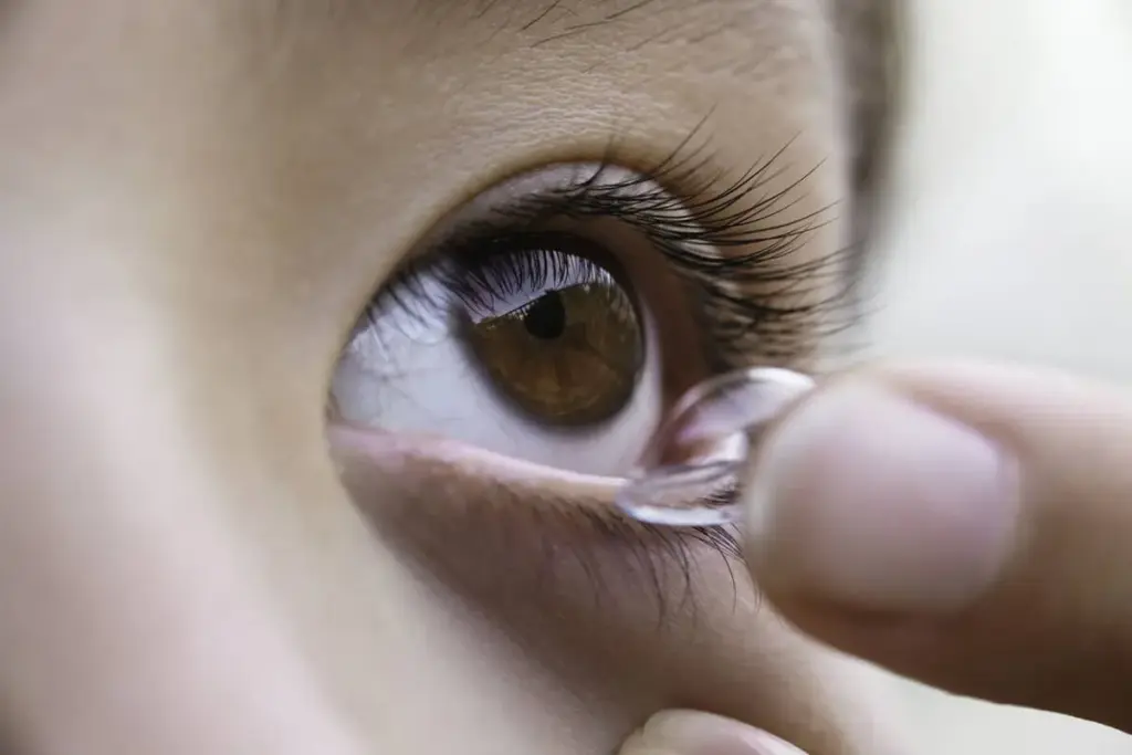 How to Get a Lost Contact Lens Out of Your Eye