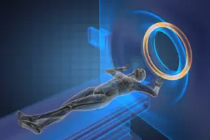 Amyloid Plaques In The Brain: Who Needs Scans