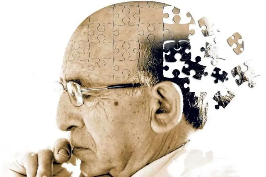Frontotemporal Dementia: Vital Differences Guide