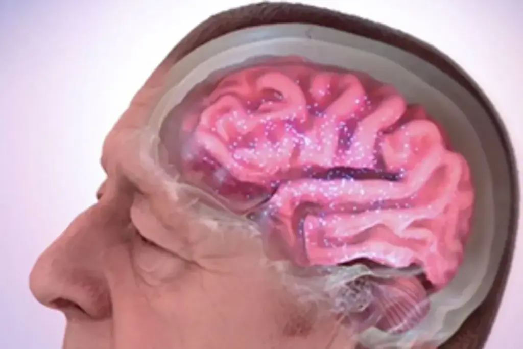 Difference: Vital Facts On Memory Loss Types