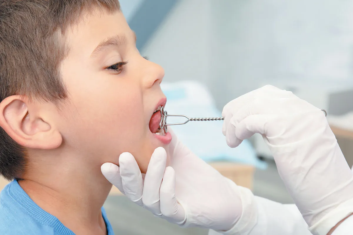 Facial And Bulbar Symptoms