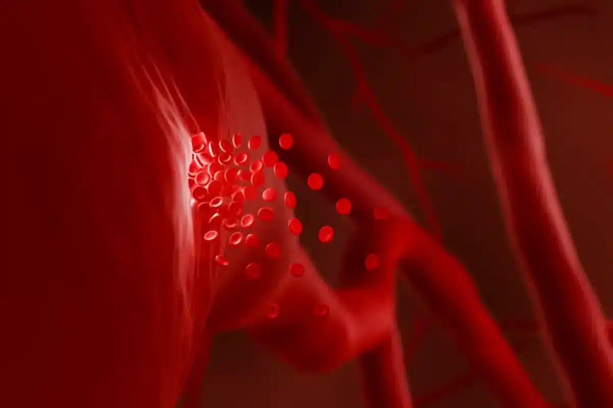 Hemophilia Causes: The Shocking Genetic Truth