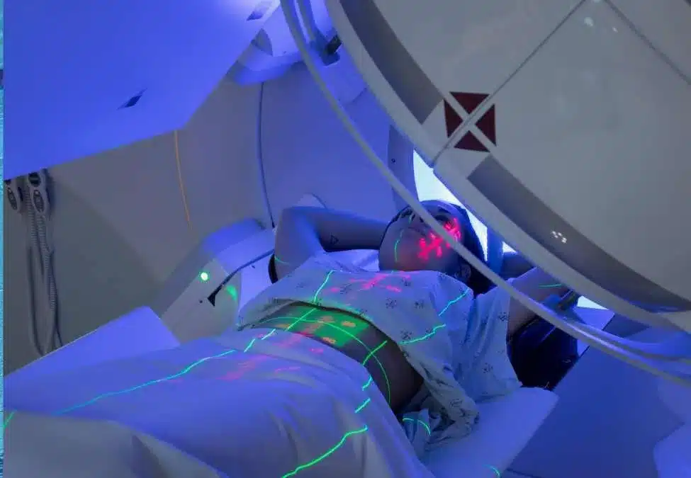 Radiation For Breast Cancer: Amazing Results