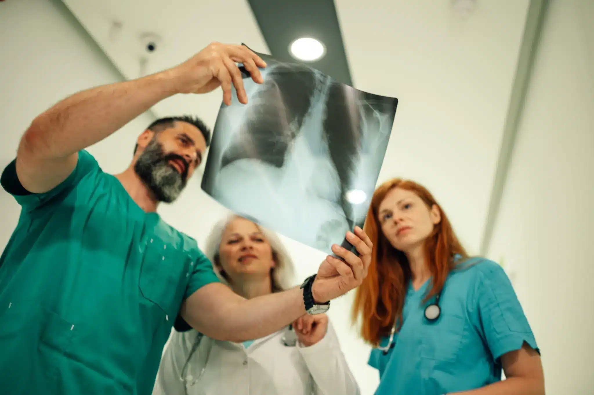 Cancerous lung tumors: Scary Growth Facts