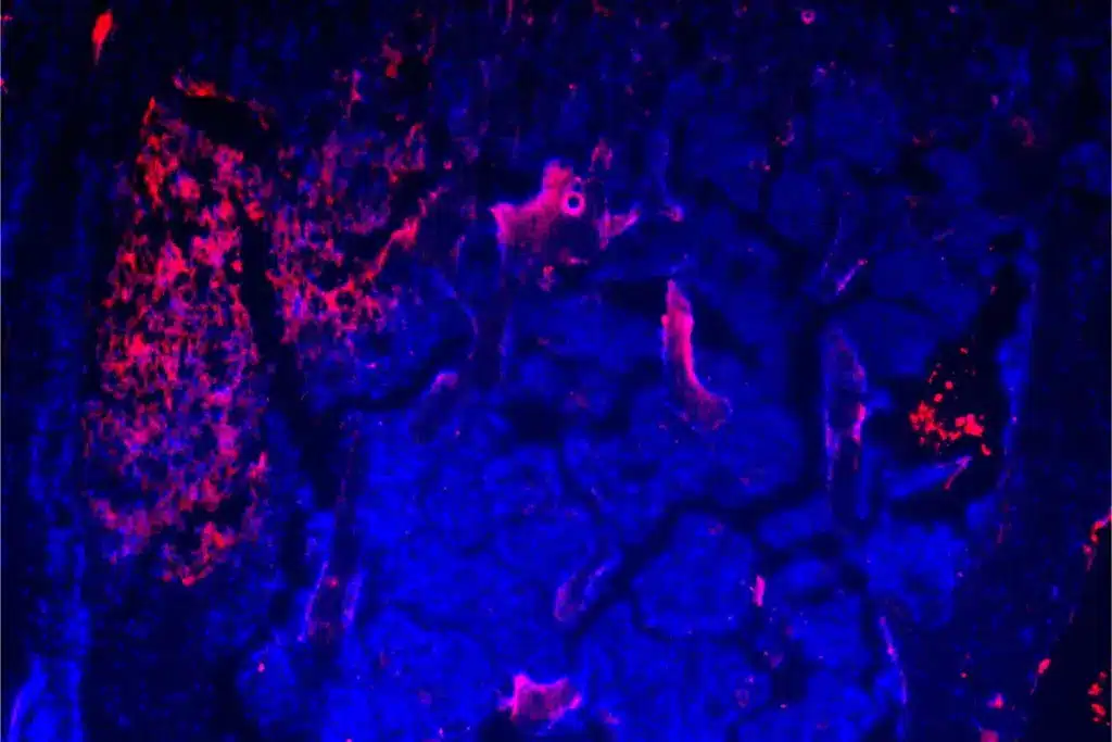 Breast Cancer: 7 Vital Habits To Quit Now