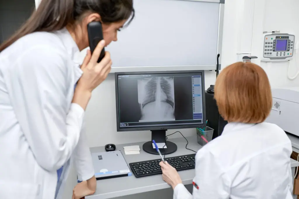 Lung Cancer Early Stage Finger Clubbing