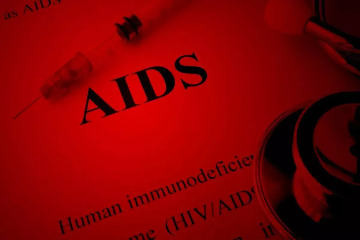 What Are the Diagnostic Criteria for AIDS Diagnosis?