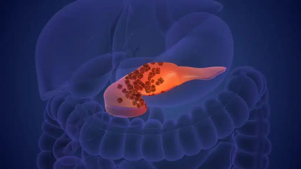 Symptoms Of Ibs: Amazing Scary Mistakes