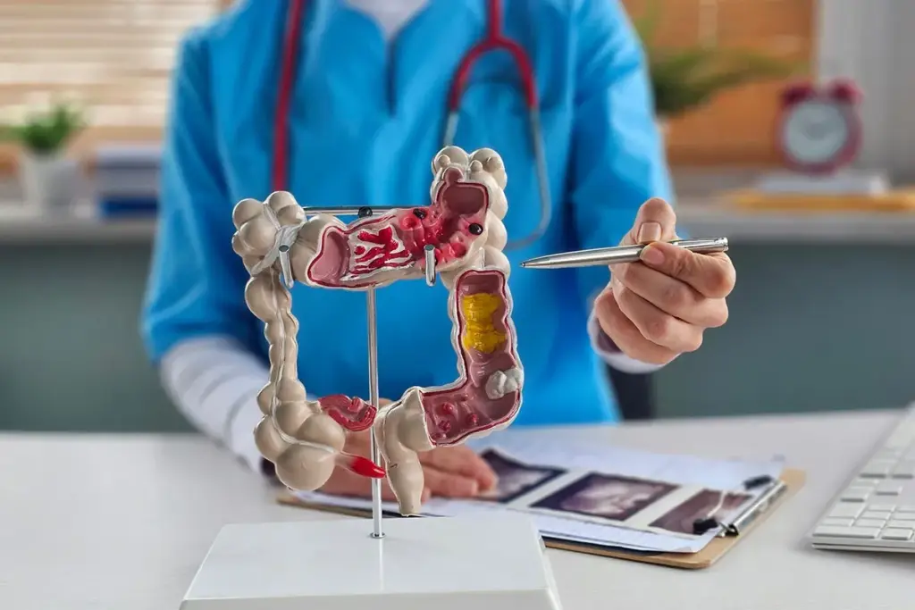 Colon Cancer Symptoms: 3 Amazing Scary Signs