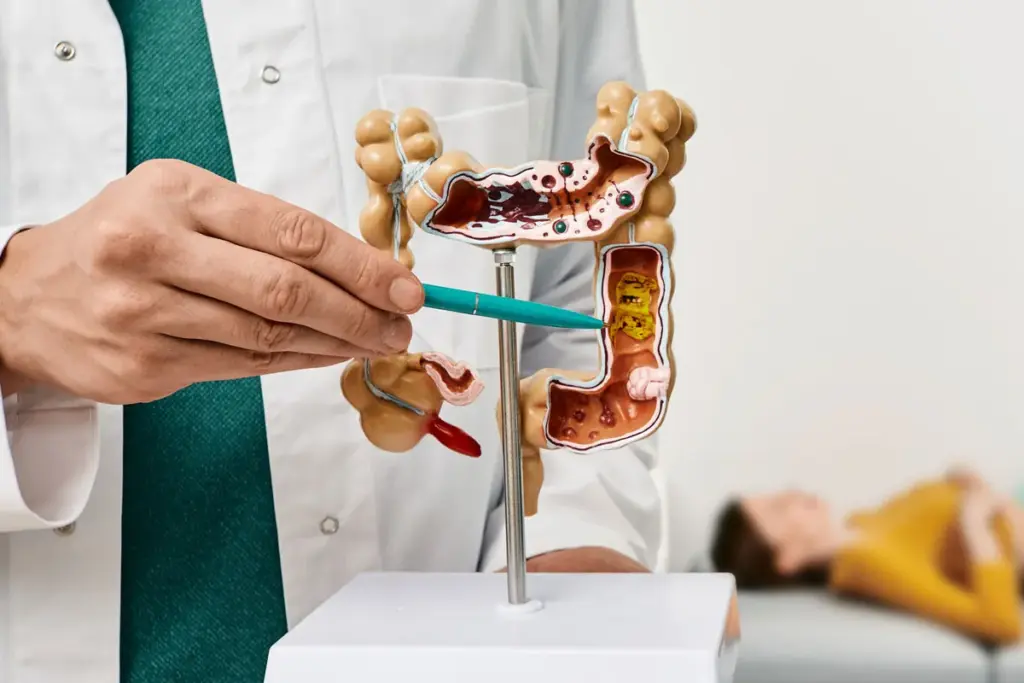 Colon Cancer Symptoms: 5 Scary Warning Signs 3 Colon Cancer Symptoms: 5 Scary Warning Signs