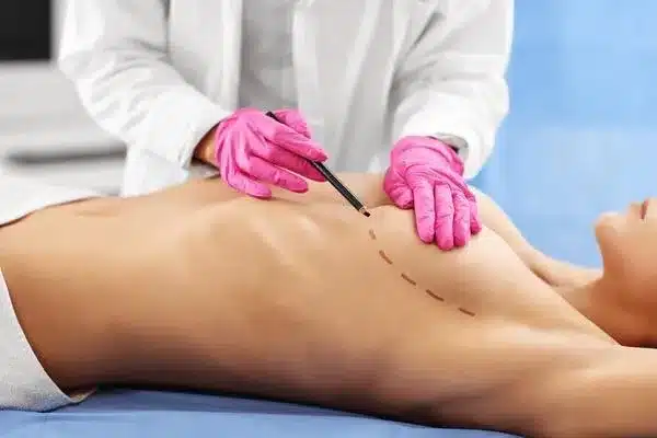 Mastectomy: Amazing Truths On Major Surgery