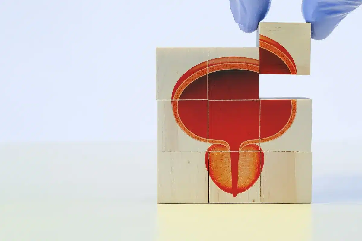 Prostate Cancer: Amazing News On Scary Cures