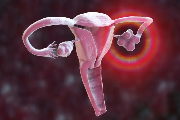 Signs Of Ovarian Cancer: Amazing Scary Warnings