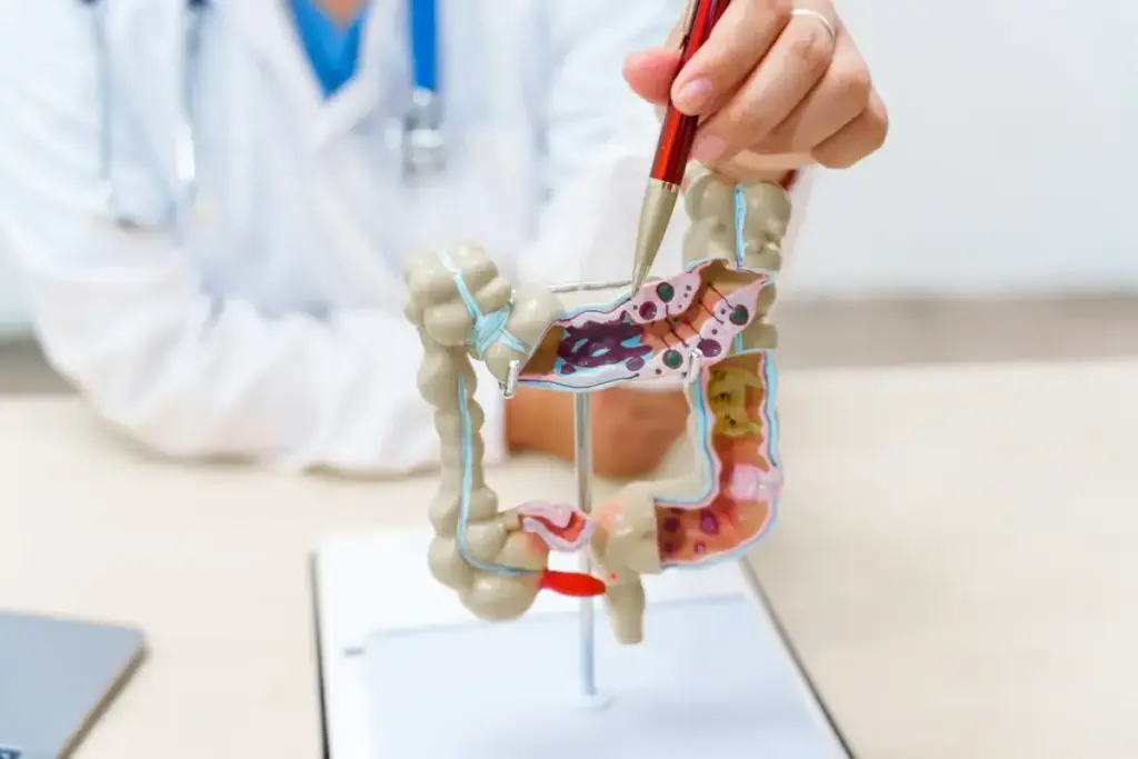 Polyp Is What? Amazing Guide To Scary Tests