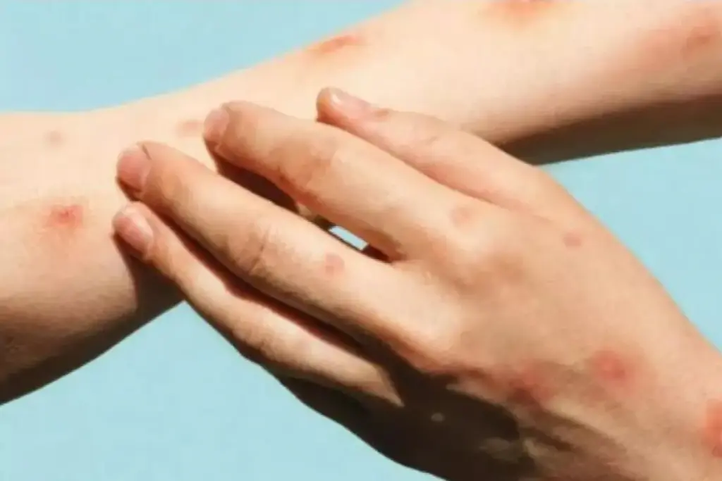 SEP 15618 image 3 LIV Hospital