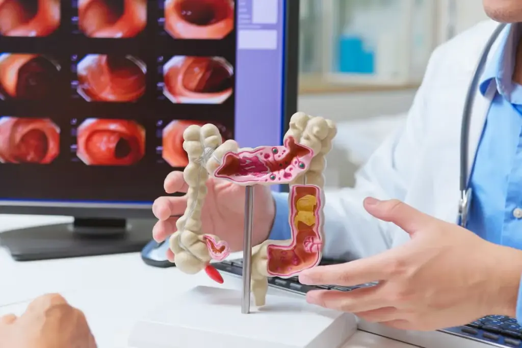 Colonoscopy Age: Amazing Scary Fact Sheets