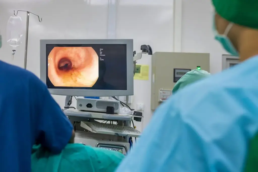 Female Colonoscopy Procedure: Amazing Privacy