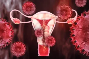Stage 1 Ovarian Cancer Symptoms: Amazing Info