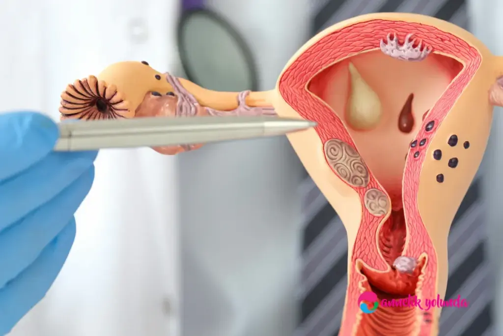 SEP 15808 image 3 LIV Hospital