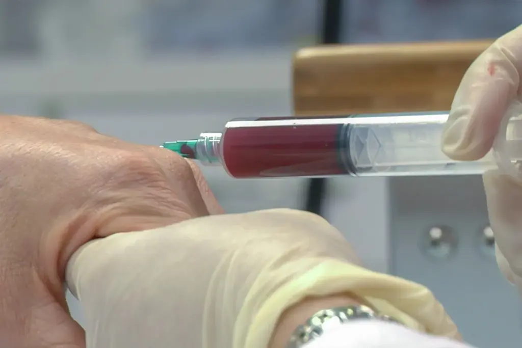 How Long Till After Emegona Tumor? Amazing