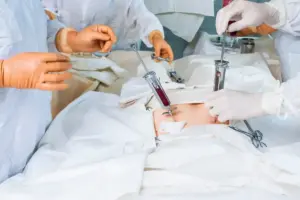 Second Autologous Stem Cell: Amazing News