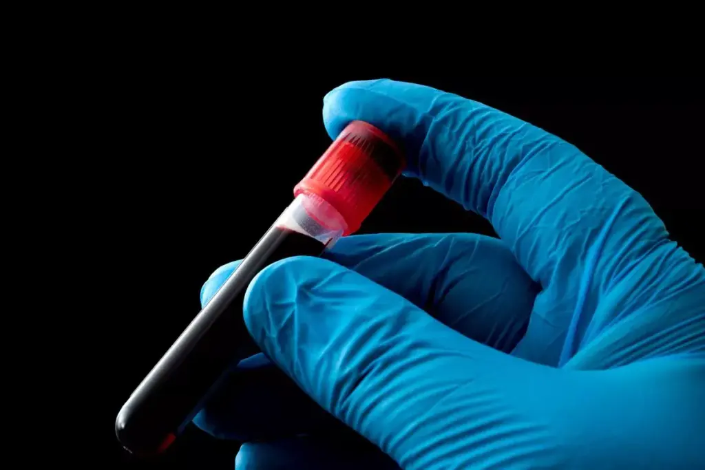 Hematologic Malignancies: Amazing Scary Truths