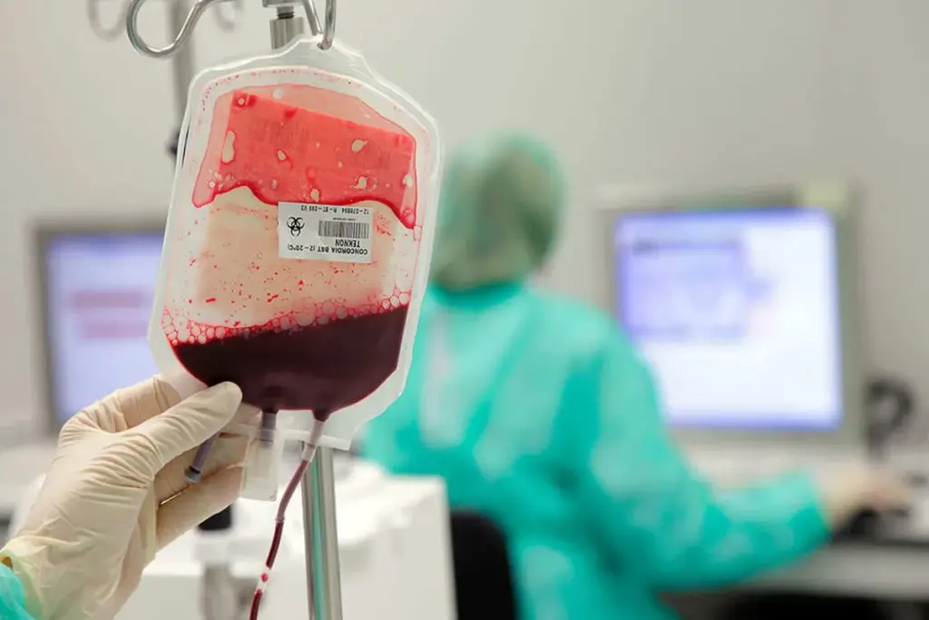 Autologous Medical Term: Amazing Scary Facts