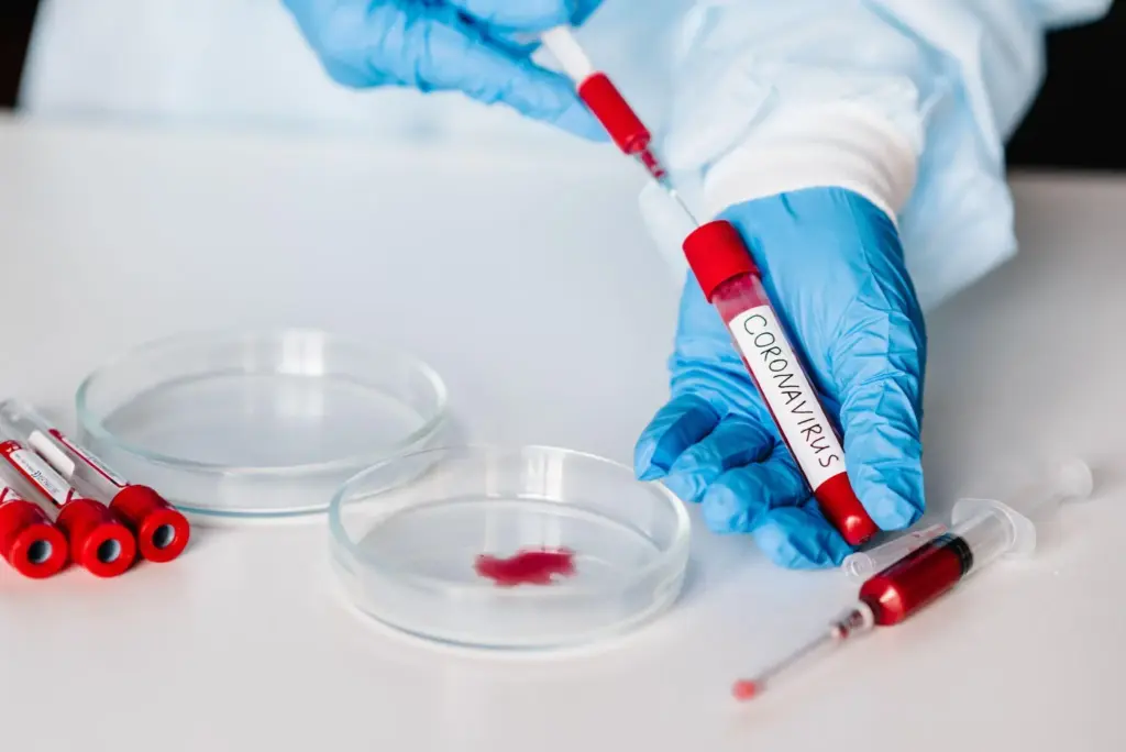 Cbc Blood Test: Amazing Scary Std Detection Tips