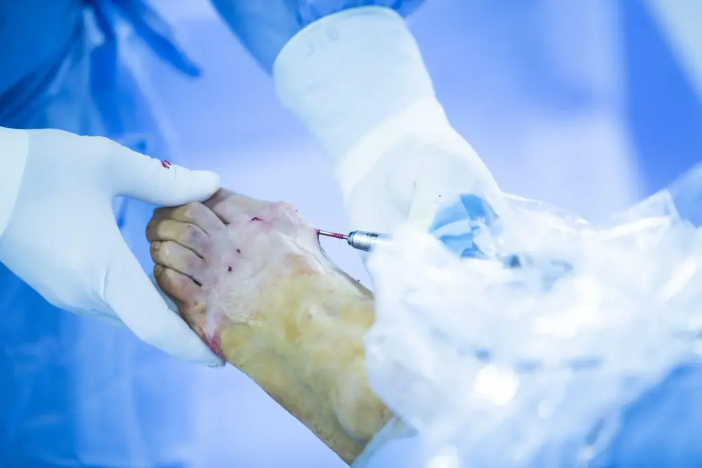 Life Expectancy After Stem Cell Transplant: 20-Year Odds